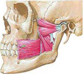 Фото гипертонус жевательных мышц