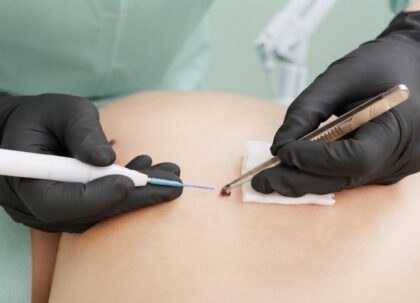 dermatosurgery-training-vinnytsia-medestet dermatosurgery-training-vinnytsia-medestet
